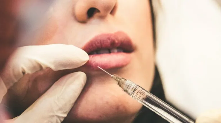 Žádný botox ani laser aneb nejčastější mýty o estetických zákrocích v létě